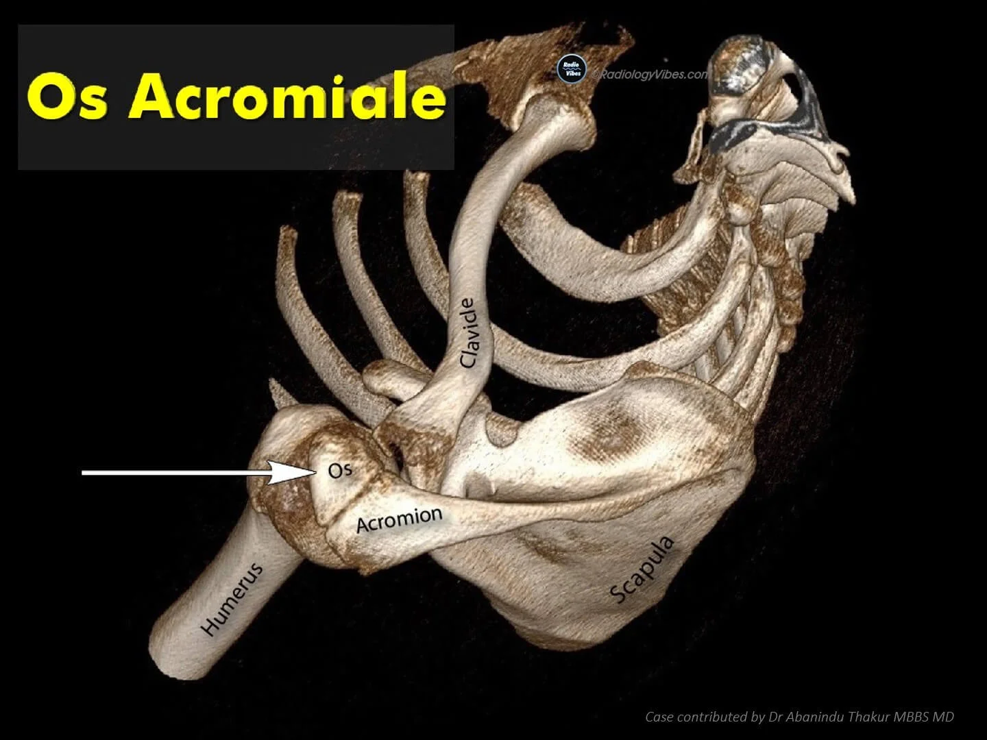 Radiology Vibes | Online Learning Platform For Radiologists.