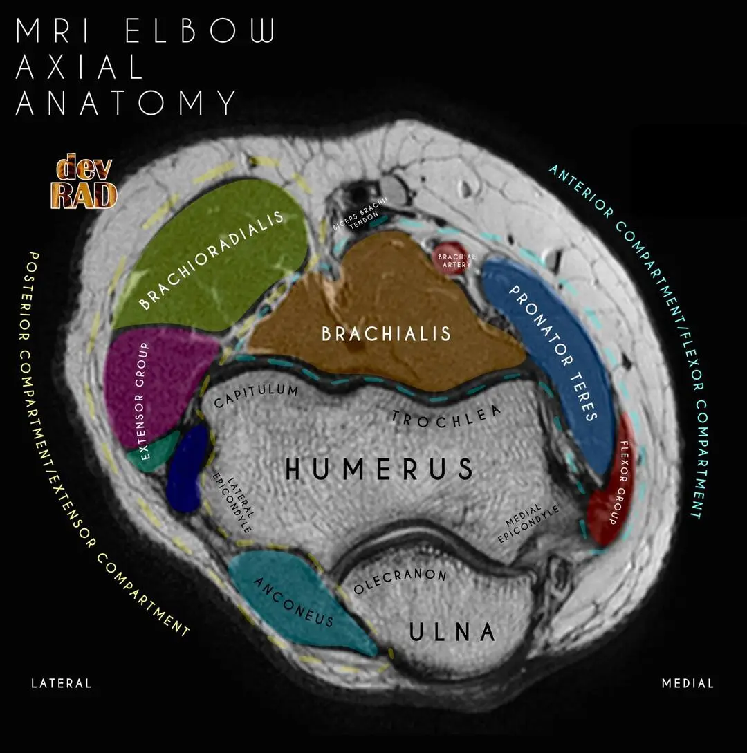 Radiology Vibes | Online Learning Platform For Radiologists.