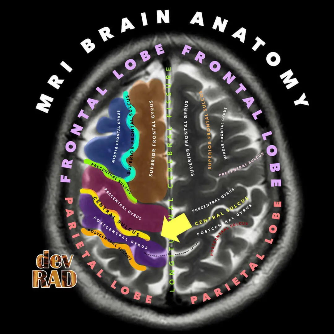 Radiology Vibes | Online Learning Platform For Radiologists.